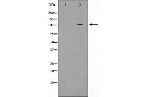 Western blot analysis on HeLa cell lysate using HSP105 Antibody,The lane on the left is treated with the antigen-specific peptide. (HSPH1 antibody  (C-Term))