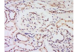 Formalin-fixed and paraffin embedded human kidney labeled with Anti-Bcl-2 Polyclonal Antibody, Unconjugated  at 1:200 followed by conjugation to the secondary antibody and DAB staining. (Bcl-2 antibody  (AA 51-150))