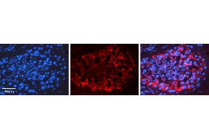 Rabbit Anti-RAD51 Antibody   Formalin Fixed Paraffin Embedded Tissue: Human Testis Tissue Observed Staining: Cytoplasm Primary Antibody Concentration: 1:100 Other Working Concentrations: N/A Secondary Antibody: Donkey anti-Rabbit-Cy3 Secondary Antibody Concentration: 1:200 Magnification: 20X Exposure Time: 0. (RAD51 antibody  (N-Term))