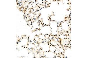 Immunohistochemistry of paraffin embedded mouse lung using HIF-3α (ABIN7074273) at dilution of 1:1600 (400x lens) (HIF3A antibody)
