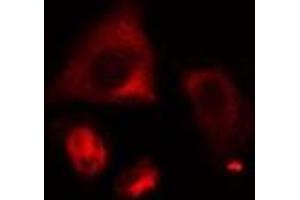 ABIN6274999 staining HeLa cells by IF/ICC. (CLN6 antibody  (Internal Region))