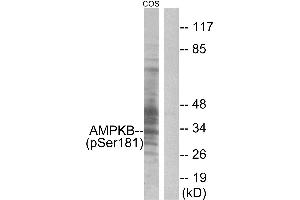 Immunohistochemistry analysis of paraffin-embedded human skeletal muscle tissue, using AMPK β1 (Phospho-Ser181) antibody. (PRKAB1 antibody  (pSer181))