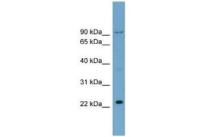 WB Suggested Anti-C15orf15 Antibody Titration: 0. (RSL24D1 antibody  (Middle Region))