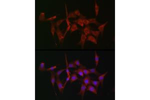 Immunofluorescence analysis of NIH-3T3 cells using [KO Validated] Fascin/Fascin/FSCN1 Rabbit pAb (ABIN3023681, ABIN3023682, ABIN3023683, ABIN1679910 and ABIN1679911) at dilution of 1:100 (40x lens). (Fascin antibody  (AA 394-493))