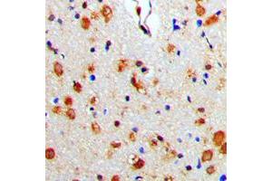 Immunohistochemical analysis of Beta-arrestin-1 staining in human brain formalin fixed paraffin embedded tissue section. (beta Arrestin 1 antibody  (C-Term))