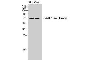 Western Blotting (WB) image for anti-CaMKIIalpha/delta (Lys542) antibody (ABIN3174151) (CaMKIIalpha/delta antibody  (Lys542))