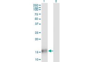 Western Blot analysis of TBCA expression in transfected 293T cell line by TBCA monoclonal antibody (M03), clone 1D2. (TBCA antibody  (AA 1-108))