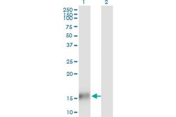 TBCA antibody  (AA 1-108)