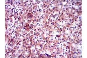 mmunohistochemical analysis of paraffin-embedded pancreas tissues using PSAP mouse mAb with DAB staining.