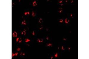 Immunofluorescence of PUMA in K562 cells with PUMA antibody at 10 ug/ml (PUMA antibody  (N-Term))