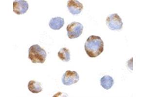 Image no. 2 for anti-BMI1 Polycomb Ring Finger Oncogene (BMI1) (Middle Region) antibody (ABIN318769) (BMI1 antibody  (Middle Region))