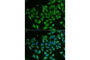 Immunofluorescence analysis of HeLa cell using CLEC3B antibody. (CLEC3B antibody)