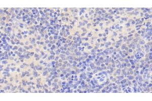 Detection of NR0B2 in Human Spleen Tissue using Polyclonal Antibody to Nuclear Receptor Subfamily 0,Group B,Member 2 (NR0B2) (NR0B2 antibody  (AA 1-257))