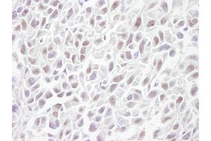 Immunohistochemistry (IHC) image for anti-Structural Maintenance of Chromosomes 3 (SMC3) (C-Term) antibody (ABIN7448804) (SMC3 antibody  (C-Term))