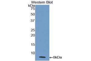 Western blot analysis of the recombinant protein. (IL18R1 antibody  (AA 375-428))