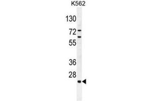 C15orf41 Antibody (Center) western blot analysis in K562 cell line lysates (35µg/lane). (BC052040 antibody  (Middle Region))