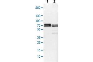 Western Blot (Cell lysate) analysis with TRAF6 polyclonal antibody  Lane 1: NIH-3T3 cell lysate (Mouse embryonic fibroblast cells) Lane 2: NBT-II cell lysate (Rat Wistar bladder tumour cells) (TRAF6 antibody)