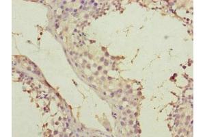 Immunohistochemistry of paraffin-embedded human testis tissue using ABIN7170586 at dilution of 1:100 (SPICE1 antibody  (AA 1-220))