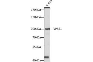 Western blot analysis of extracts of A-549 cells, using VPS51 antibody (ABIN7271280) at 1:1000 dilution. (VPS51 antibody  (AA 1-260))