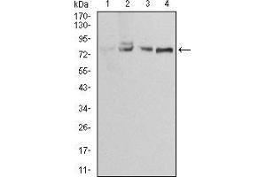 Western Blotting (WB) image for anti-Ezrin (EZR) (AA 292-464) antibody (ABIN5886560) (Ezrin antibody  (AA 292-464))