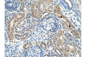 CRELD1 antibody was used for immunohistochemistry at a concentration of 4-8 ug/ml. (CRELD1 antibody  (C-Term))