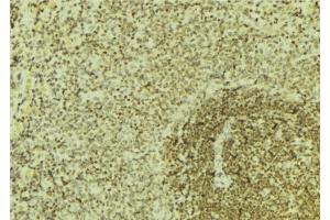 ABIN6276675 at 1/100 staining Mouse pancreas tissue by IHC-P.