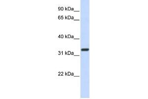 WB Suggested Anti-Nkx2-5 Antibody Titration: 0.