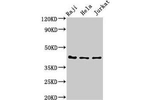 Western Blot Positive WB detected in: Raji whole cell lysate, Hela whole cell lysate, Jurkat whole cell lysate All lanes: Pregnancy-associated glycoprotein 1 antibody at 3 μg/mL Secondary Goat polyclonal to rabbit IgG at 1/50000 dilution Predicted band size: 43 kDa Observed band size: 43 kDa (PAG1 antibody  (AA 54-380))