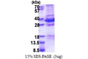 SDS-PAGE (SDS) image for Melanoma Antigen Family D, 1 (MAGED1) (AA 504-760) protein (His tag) (ABIN6387343) (MAGED1 Protein (AA 504-760) (His tag))
