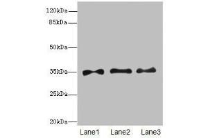 Western blot All lanes: PRPS1antibody at 6. (PRPS1 antibody  (AA 1-318))
