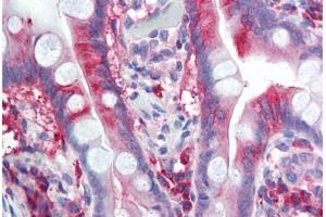 Anti-CACNA1C / Cav1. (CACNA1C antibody  (Internal Region))