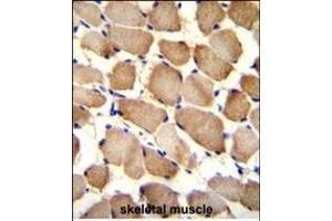 ARL17P1 Antibody (Center) (ABIN655544 and ABIN2845053) immunohistochemistry analysis in formalin fixed and paraffin embedded human skeletal muscle followed by peroxidase conjugation of the secondary antibody and DAB staining. (ARL17A antibody  (AA 102-130))