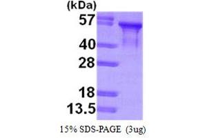 SDS-PAGE (SDS) image for tau Protein (AA 1-381) protein (His tag) (ABIN667844) (tau Protein (AA 1-381) (His tag))