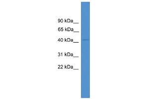 WB Suggested Anti-TXNIP Antibody Titration: 0. (TXNIP antibody  (Middle Region))