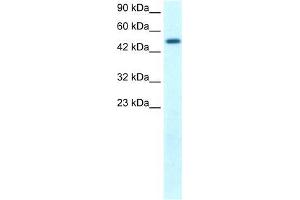 Human Kidney; WB Suggested Anti-FLJ14768 Antibody Titration: 1. (FIZ1 antibody  (C-Term))