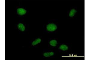 Immunofluorescence of purified MaxPab antibody to PHF19 on HeLa cell. (PHF19 antibody  (AA 1-207))