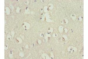 Immunohistochemistry of paraffin-embedded human brain tissue using ABIN7167620 at dilution of 1:100 (RGS7 antibody  (AA 1-300))
