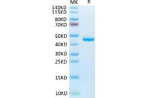 Mouse SLPI on Tris-Bis PAGE under reduced condition. (SLPI Protein (AA 26-131) (Fc Tag))