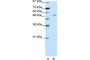 WB Suggested Anti-ZNF498 Antibody Titration:  5. (Zinc Finger and SCAN Domain Containing 25 (ZSCAN25) (C-Term) antibody)