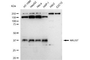 Western blotting analysis using HAUS7 antibody (ABIN7798838). (Recombinant HAUS7 antibody)