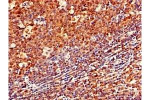 Immunohistochemistry of paraffin-embedded human tonsil tissue using ABIN7145141 at dilution of 1:100 (CD79a antibody  (AA 70-142))