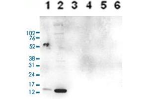HIST1H3A antibody  (2meArg17 (asymetric), acLys18)
