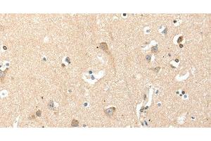 Immunohistochemistry of paraffin-embedded Human brain tissue using RRAD Polyclonal Antibody at dilution 1:50 (RRAD antibody)