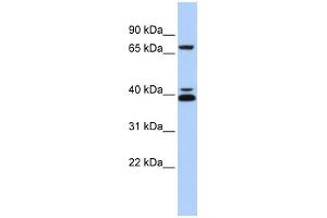 WB Suggested Anti-GATA6 Antibody Titration: 0. (GATA6 antibody  (Middle Region))