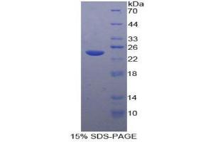 SDS-PAGE (SDS) image for Tachykinin Receptor 2 (TACR2) (AA 92-290) protein (His tag) (ABIN2122172)