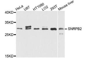 Western blot analysis of extracts of various cell lines, using SNRPB2 antibody (ABIN5995782) at 1/1000 dilution. (SNRPB2 antibody)