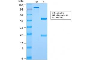 SDS-PAGE Analysis Purified c-Myc Rabbit Recombinant Monoclonal Antibody (MYC2895R). (Recombinant c-MYC antibody  (C-Term))