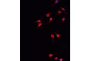 ABIN6266454 staining MCF-7  cells by IF/ICC. (Retinoblastoma 1 antibody  (pThr826))
