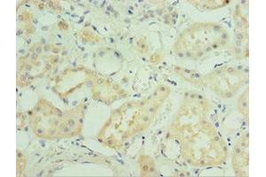 Immunohistochemistry of paraffin-embedded human kidney tissue using ABIN7160003 at dilution of 1:100 (MAPK4 antibody  (AA 348-587))
