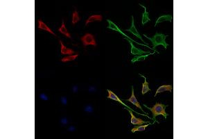 ABIN6258550 and ABIN6275237 staining 3 by IF/ICC.